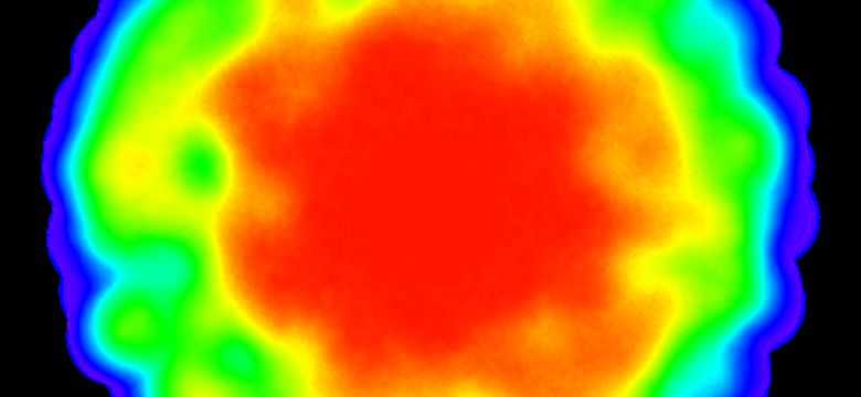 Congressen en meetingtrends: meer content, minder concentratie